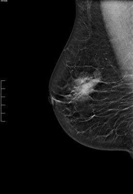 Цифровой маммограф Planmed Clarity